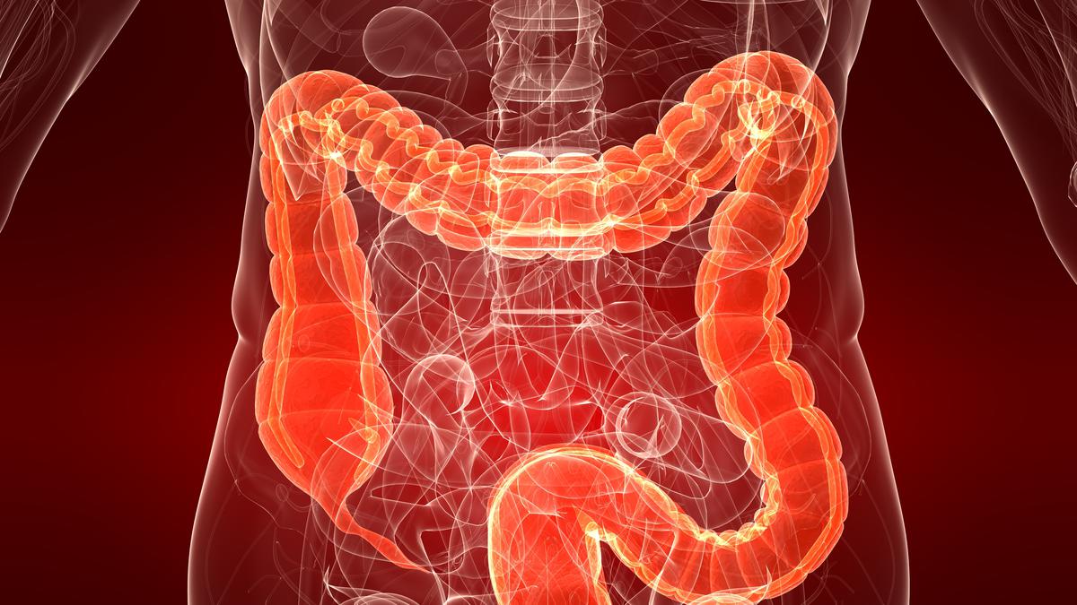 ¿Qué alimentos pueden ayudar a desinflamar el colon?