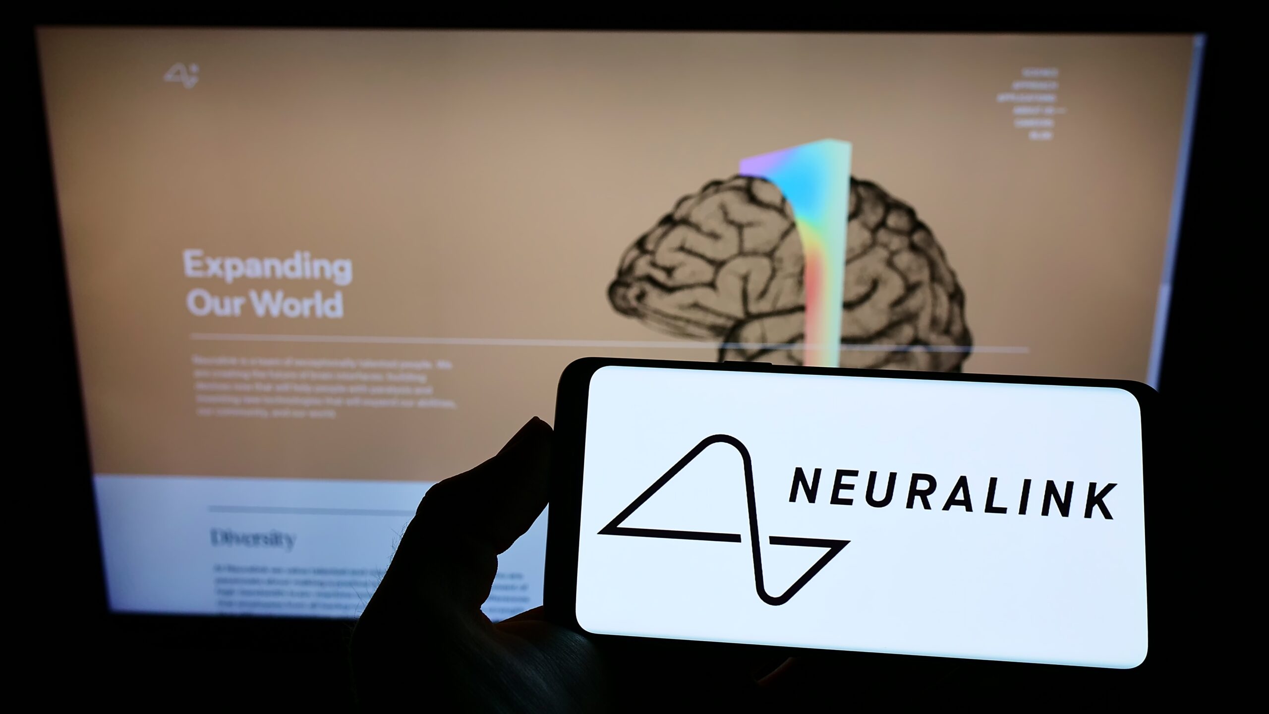 Implante cerebral de Neuralink falla: detectan problemas en el hombre al que le pusieron chip – El Diario NY